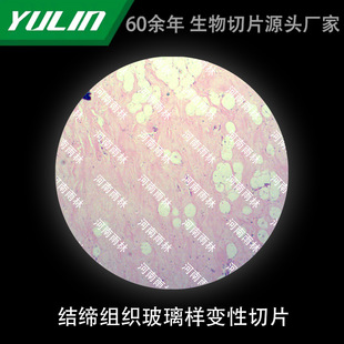 �Y���M��������׃����Ƭ�����@΢�R�˱�����ֲ�：���d��Ƭ�^��