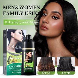 �����ZȾ�l���Z����һ֧��ֲ�����w�ײ����lһϴ��Ȼ��Ⱦ�l��羳