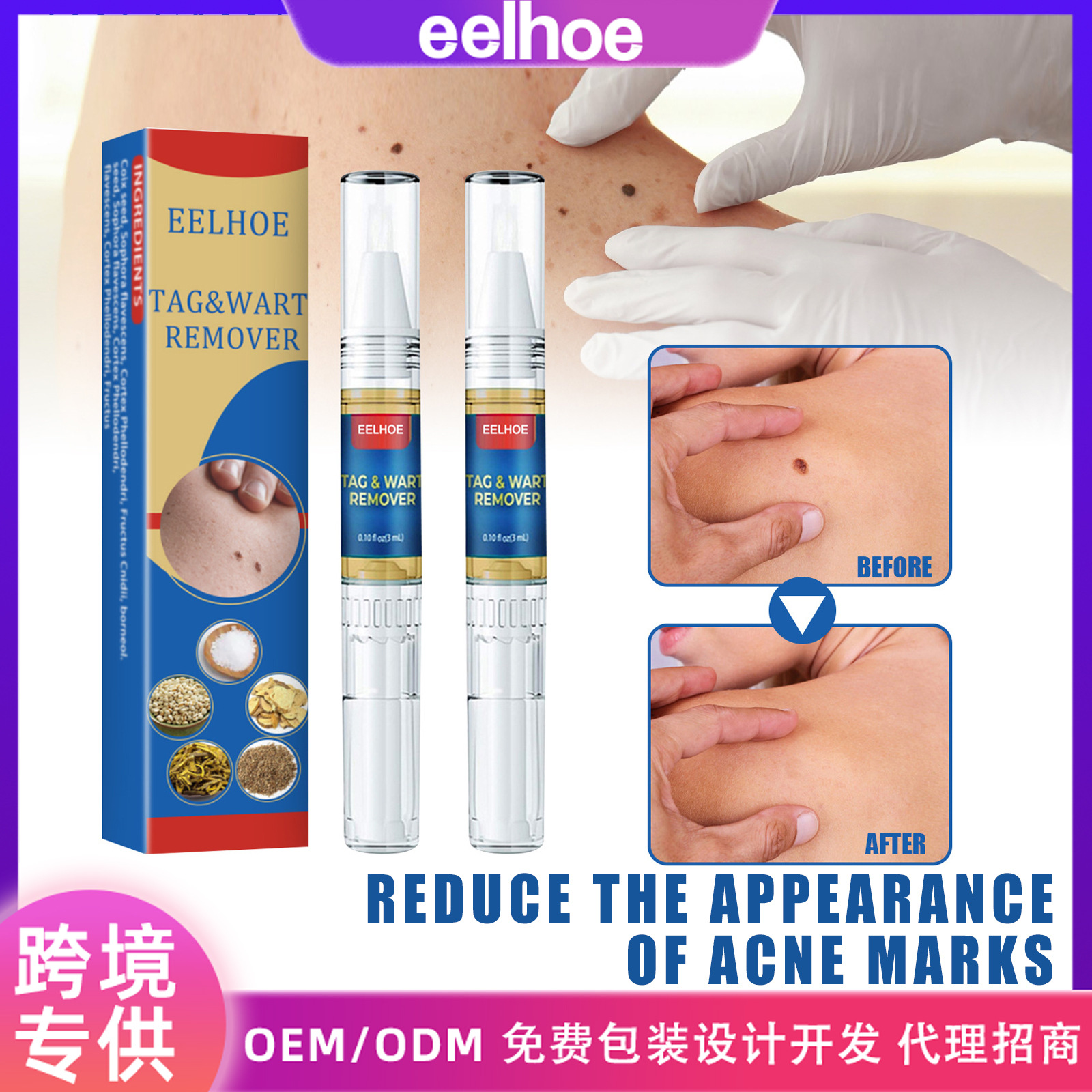 EELHOE Skin Wart and Moles Removal Pen, Body Skin Wart and Moles Removal Solution, Skin Care Repair and Maintenance Liquid