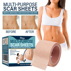 South moon膚色遮瑕貼 遮蓋身體胎記傷疤紋身斑點防水色貼遮蓋貼