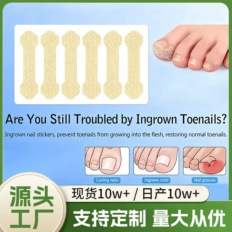 哇噢定制跨境正甲贴脚趾嵌甲贴改善甲沟内卷指甲贴套装指甲矫正贴