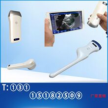 彩色多普勒检测仪便携式掌上B超仪检测仪彩色B超手持B超机医院用