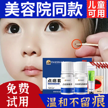 点痣膏无痕正药膏水点痣笔脸部用去非药水液留疤神器旗舰店批发代