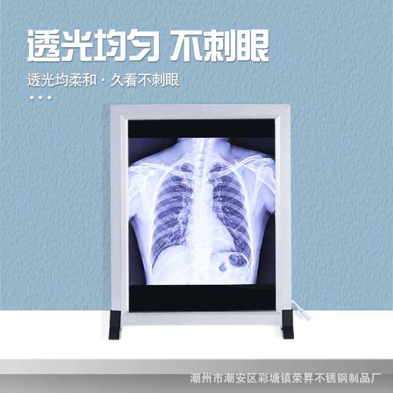 Lámpara de visualización de rayos X caja de luz LED lámpara de imagen médica ortopédica sola cirugía triple CT película Lámpara de lectura cuádruple atenuación