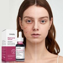 跨境爆款果酸精华液原液祛痘粉刺软化角质杏仁酸精华外贸现货批发