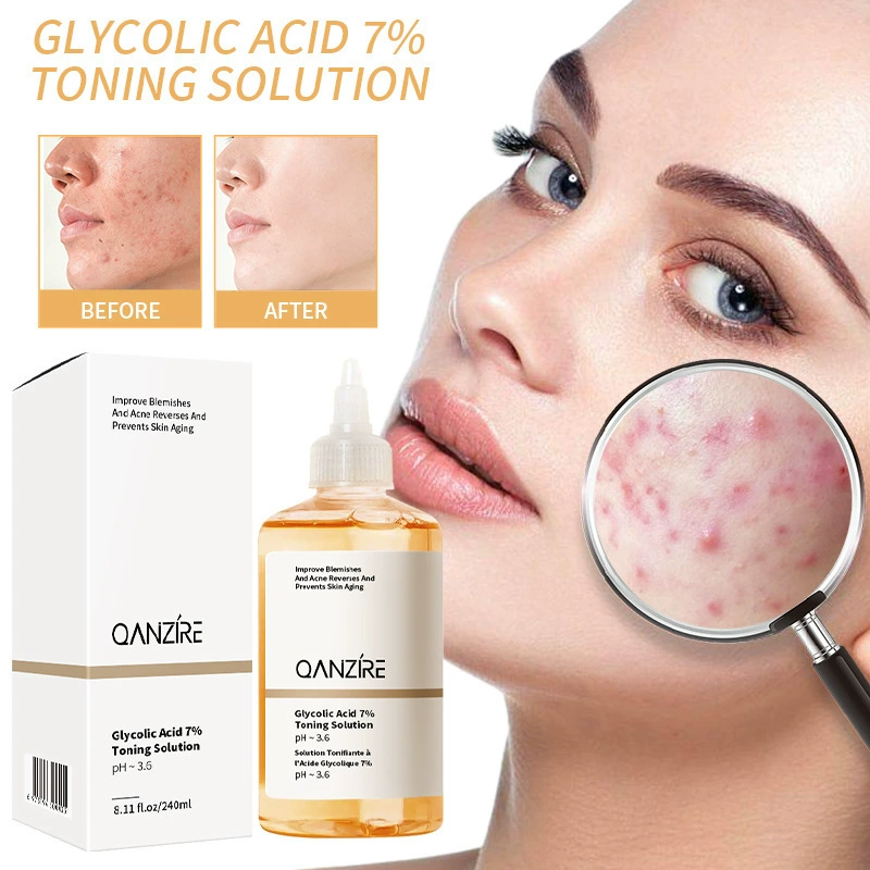 Трансграничное Специально для 7% гликолевой тоник Glycolic acid toner Отшелушивание гликолевой сыворотки