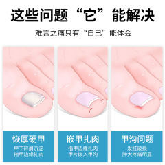 Special nail clipper for nail groove, hawkbill pliers, nail groove ingrown nail clipper, nail scissors set, dead skin pliers, pedicure tool, inflammation