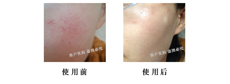 O1CN01l5X00A2FMDdh2aZ2F_!!1060