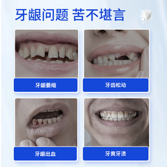 Dental separation agent, gum recession, loose teeth, consolidation, periodontal care, cleaning and separating toothpaste, factory wholesale