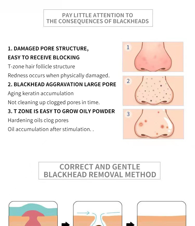 Blackhead Export Liquid Image 4