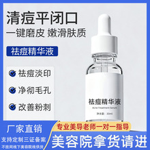 ����Ժ��������AҺ�����沿����ë�״ִ��澏�aˮ�����AҺ