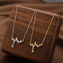 �羳�¿��OӋ��늈D΢肵�������Ů����ɫ�r�����i������l