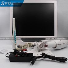 牙科内窥镜 口腔内窥镜 牙科内窥镜一体机 牙科内窥镜 专用高清