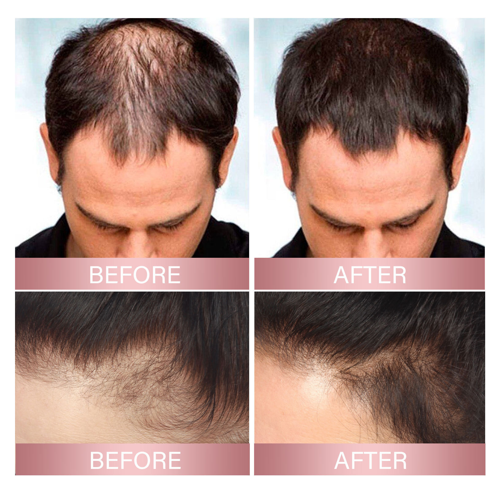 EELHOE Spray per spessore dei capelli al riso Forte riparazione dei capelli radice del follicolo pilifero prevenzione della caduta dei capelli spray per la cura dei capelli ispessimento dei capelli solidi_voghion.com