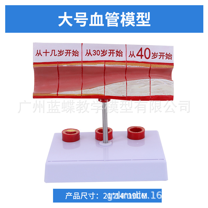 ���������״��������Ѫ�ܶ���ģ��Ӳ��ģ����������ģ��Ѫ˨ģ��