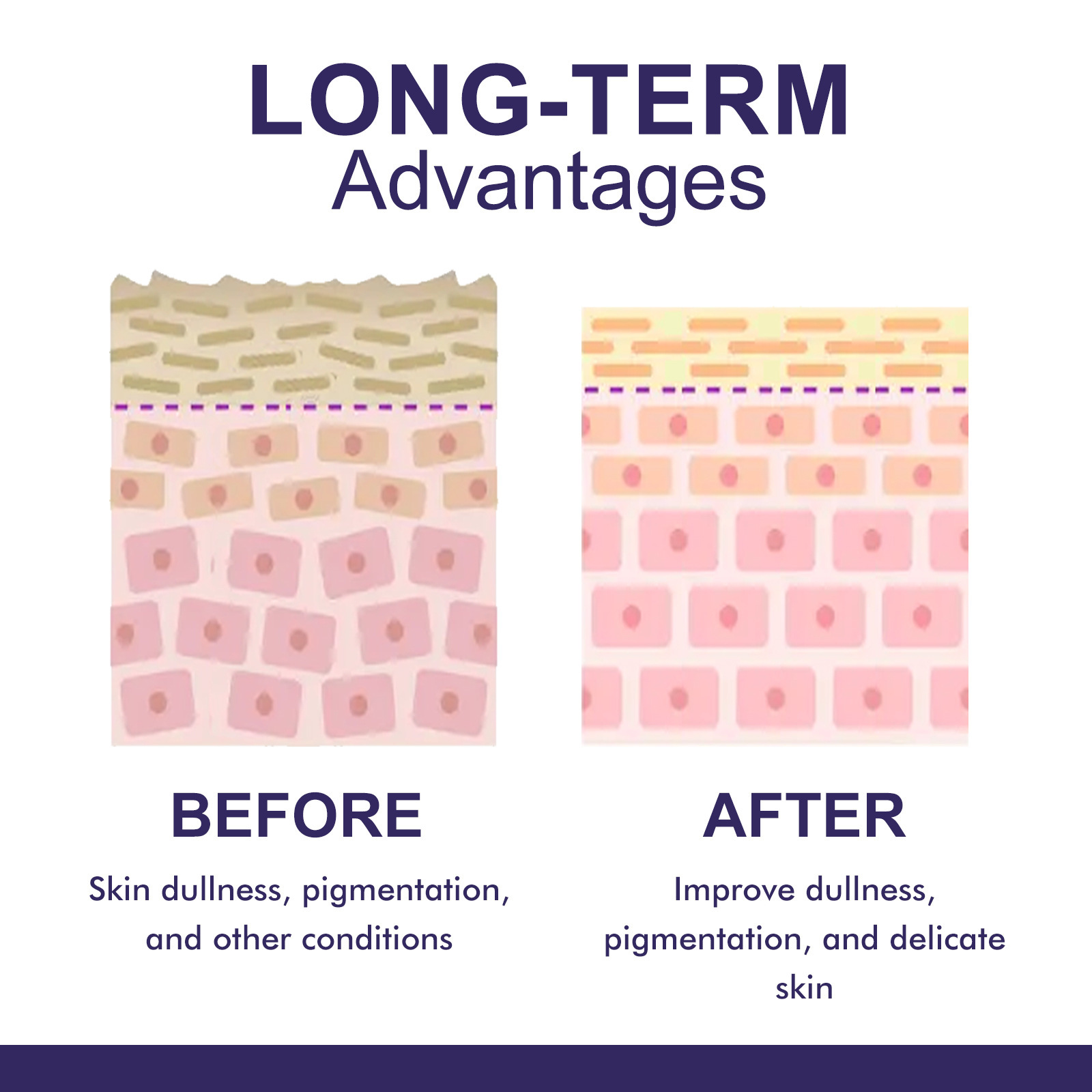 Dark Spot Corrector Cream For Elbow And Underarm Skin Brightening_voghion.com