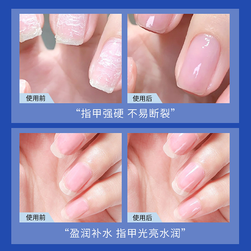 Anchuyt研春堂盈润保湿护甲精华液滋润强韧亮泽护甲防断裂倒刺女|undefined
