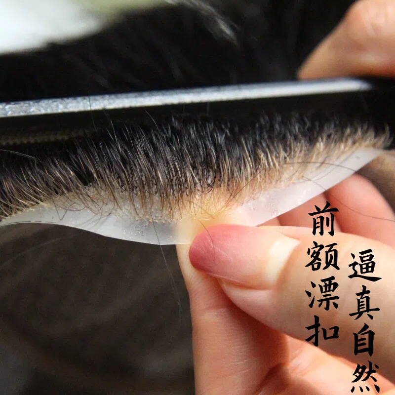 Xuchang Handmade Full Needle-Injection Men's Hairpiece with Real Hair, Invisible Seamless Hairline for Top Hair Replacement