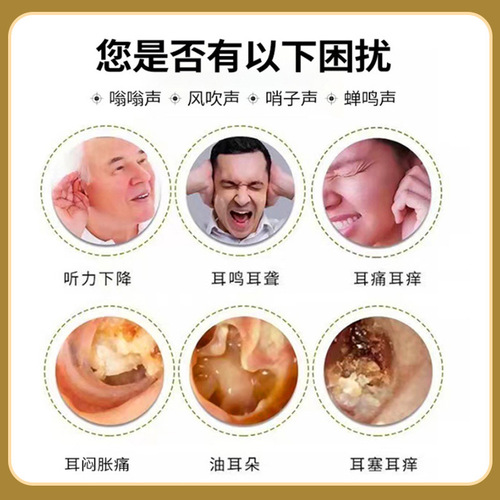 Miaogufang tinnitus cream, ear health care cream, buzzing ears, hearing loss, ear care acupoint paste