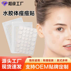 痘痘贴隐形透气吸脓遮瑕贴学生熬夜净痘贴36粒工厂批发