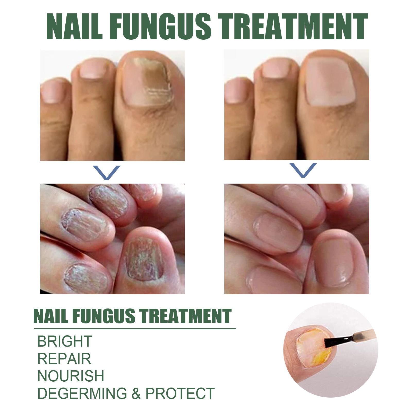 EELHOE Nail Care, una solución de hidratación suave y limpia para uñas gruesas y suaves en la superficie de las uñas. image 4