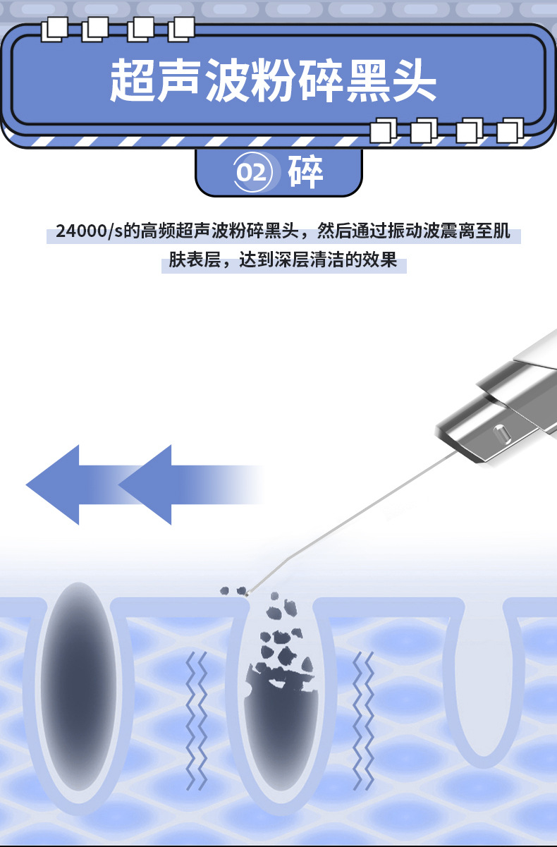 私模超声波铲皮机毛孔清洁器洁面去黑头铲美容仪器导入导出铲皮刀详情19