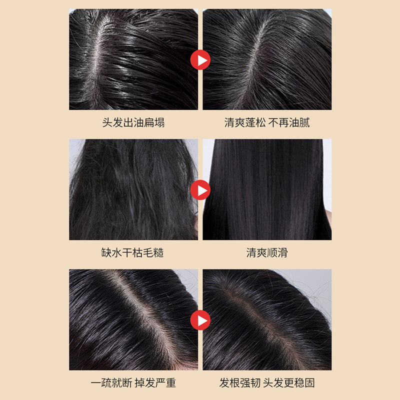 生姜と何首烏のシャンプー、オイルコントロール、ふんわり、フケ防止、かゆみ止め、毛髪強化、根元強化、国産、老舗、檜の葉シャンプー|undefined