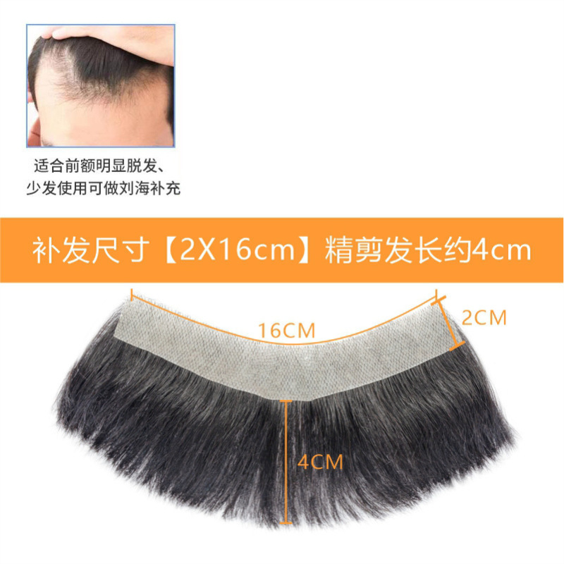 发际线假发贴假刘海假发片m形发际线贴男一片式前额补发自然真发|undefined
