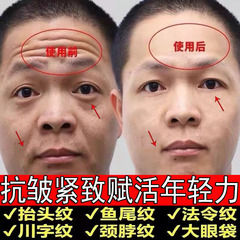 コラーゲン充填パウダー、ほうれい線、顔のくぼみ、保湿、小じわエッセンス、VCクリーム、正規卸売スペシャル