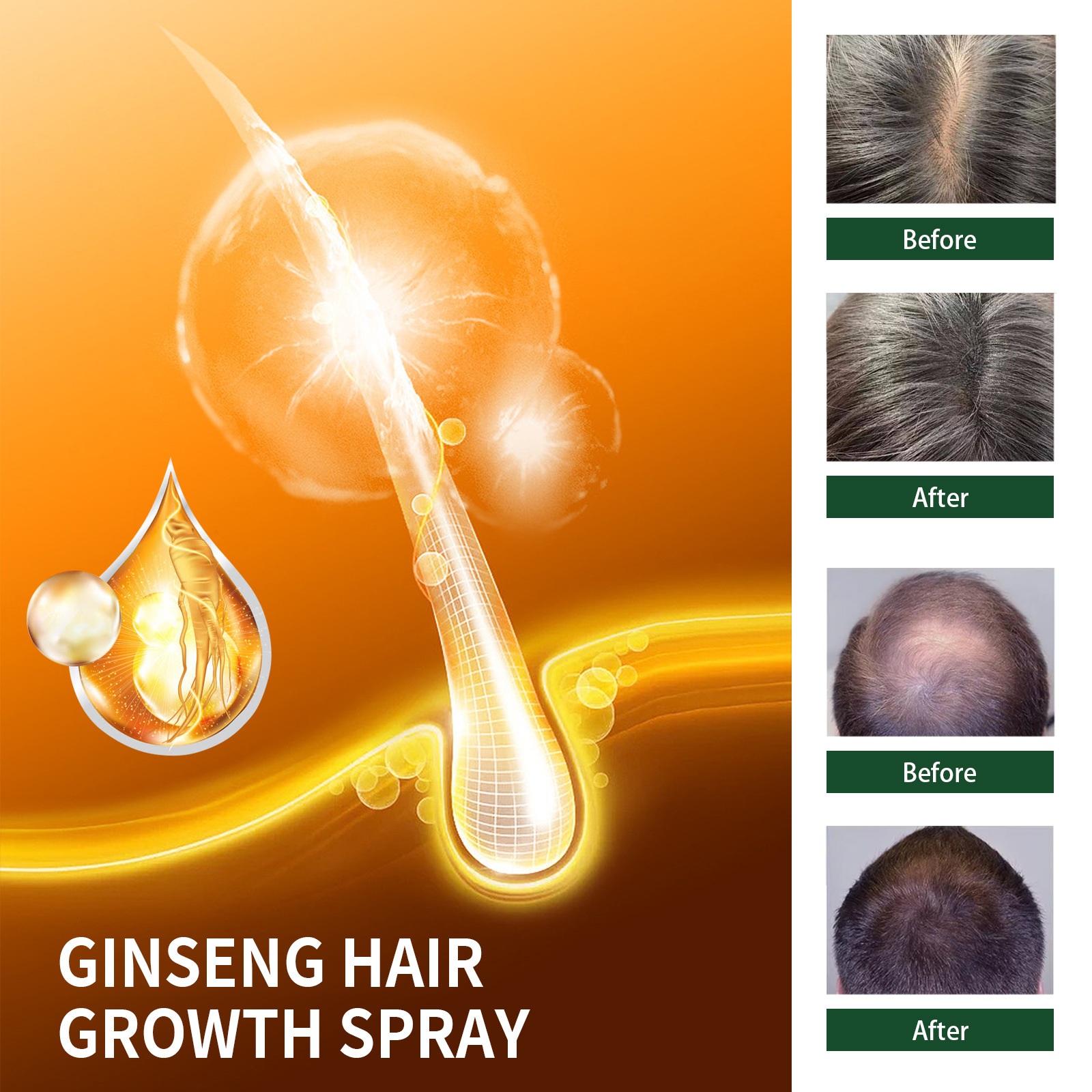 EELHOE Ginseng Hair Thickness Spray, hair care and hair care improvement, hair care, moisturizing and anti-hair loss nutrition spray_voghion.com