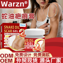 warzn���Ͱ̺۸����uͨ���N Ƥ�w�o�����������Q�S�ҬF؛���l1