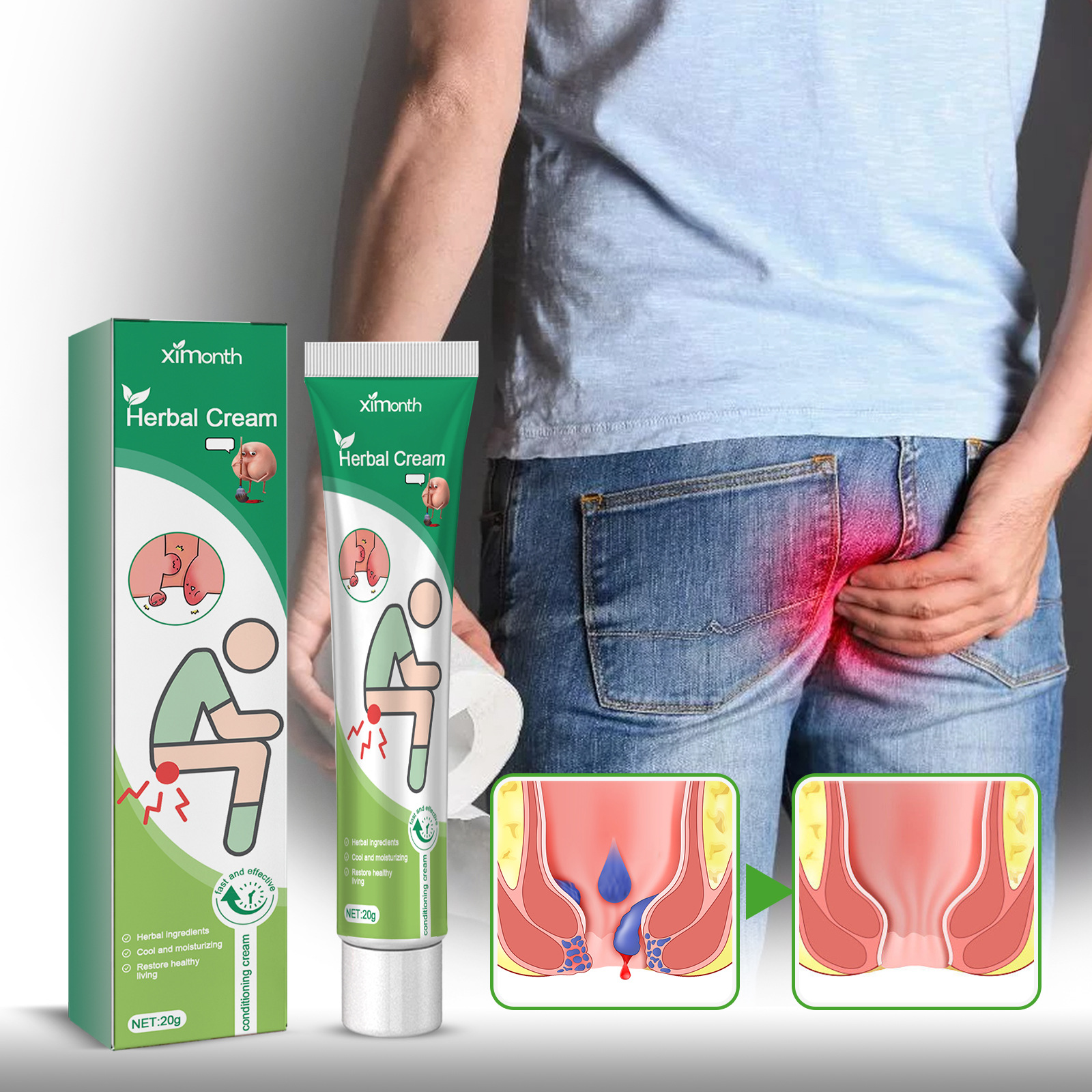ximonth Hemorrhoid Cream Image 3