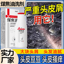 【日本配方】煤焦油洗劑去屑止癢毛囊 炎頭皮痘痘蟎蟲控油洗 發水