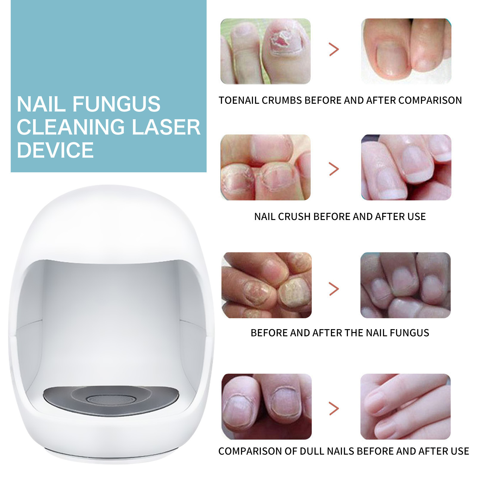 Portable Nail Treatment Device