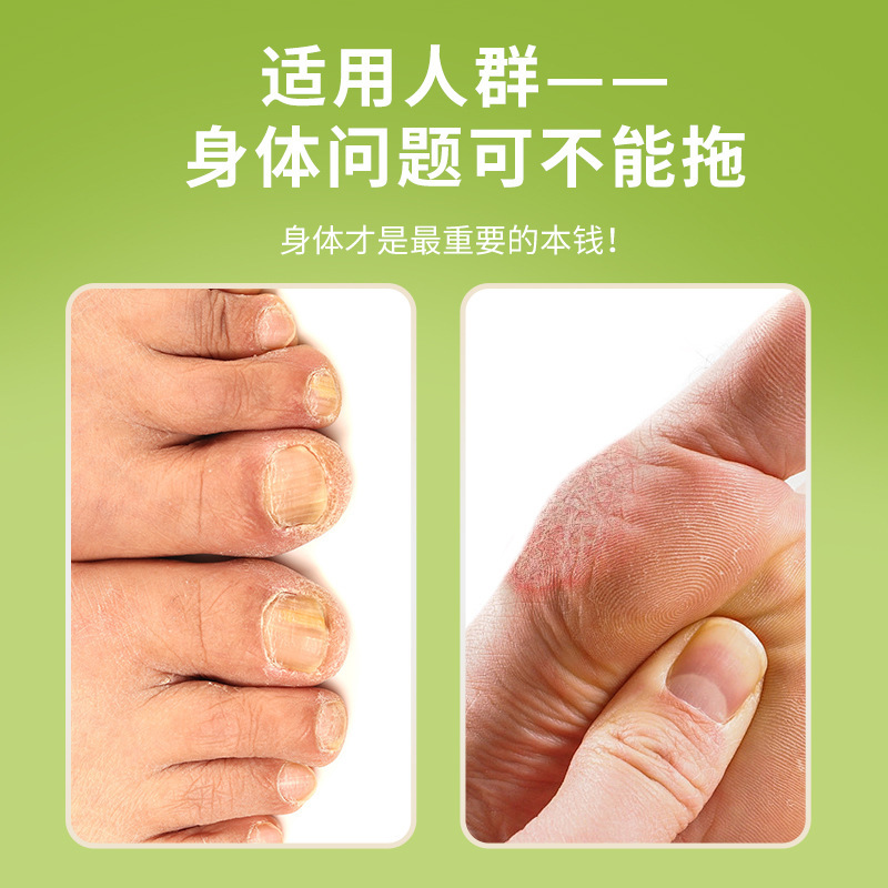 香港大药房真菌王手足外用保健乳膏足部瘙痒膏手足脱皮膏批发|undefined