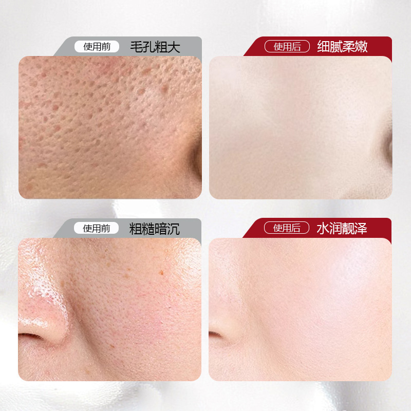 Baoweiquan nicotinamida Gel mejora el tono de la piel facial, opaco y delicado, poros finos, crema hidratante de piel amarilla y negra, fabricante de cremas image 3