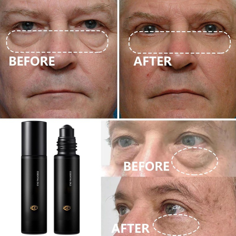 Zevorify Eye Repair Stick, una varita de reparación de ojos que hidrata y protege la circunferencia de los ojos.