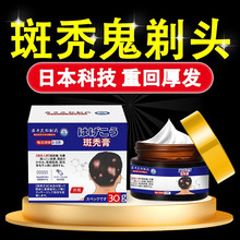 岩井昃弘斑秃鬼剃头膏药专用脂溢性脱发发际线秃头头发生长液育发