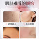Hanji Double Antibody Compact Brightening Clear Water Clear Milk Moisturizing Anti-Wrinkle Toner Emulsion Water suit for Women
