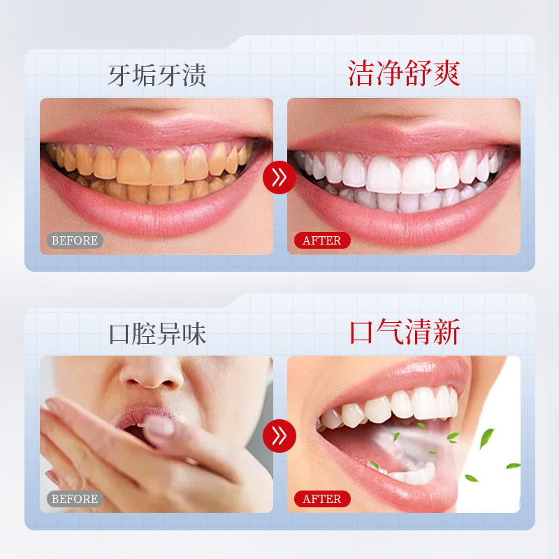 歯の職人の歯科の分離剤の歯磨き粉の深さはきれいで清新な息をきれいにして歯を保護します。|undefined