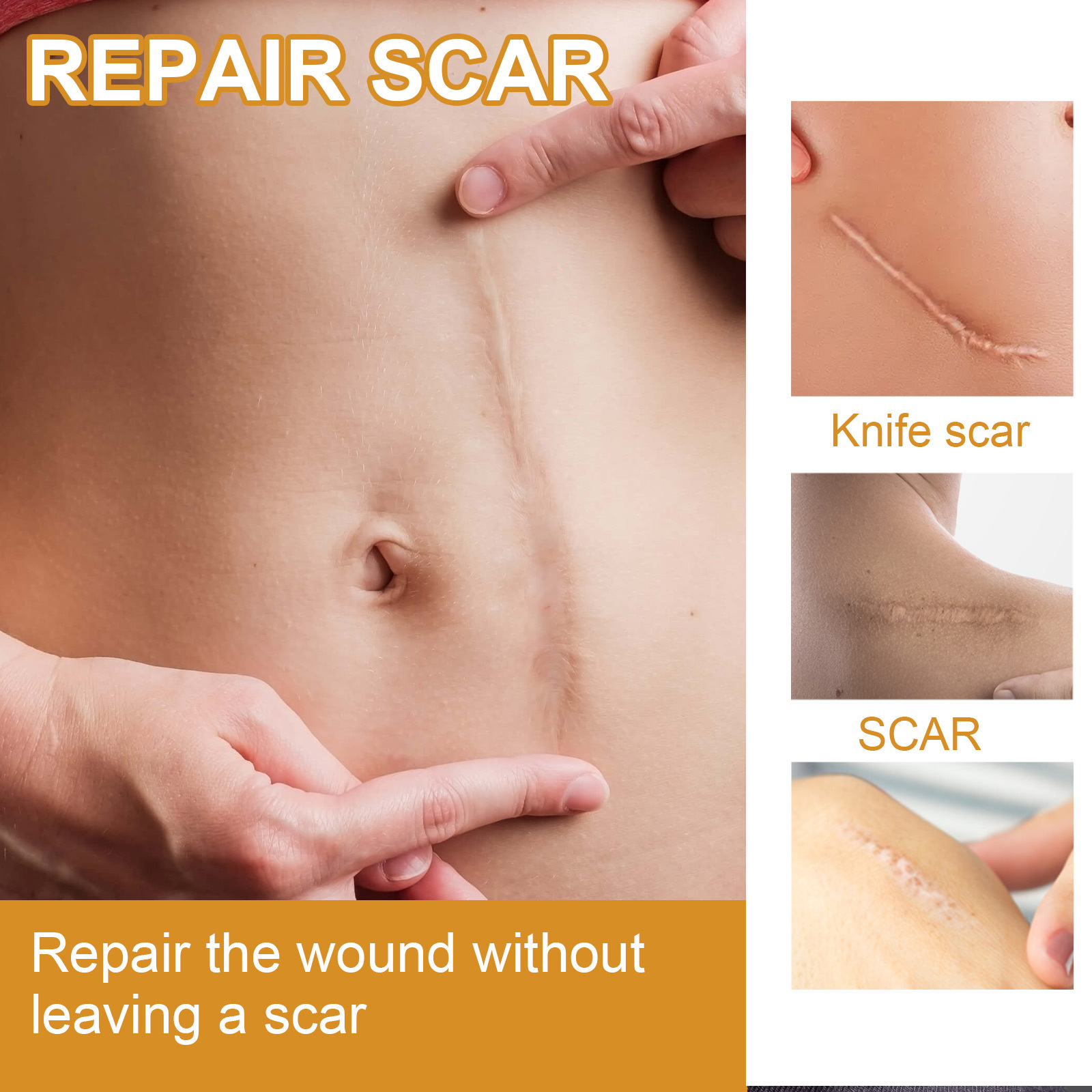 EELHOE Scar Cream Fading Hud Trauma Reparation Forbrænding Forbrænding Fading Cream Kirurgisk reparation Scar Scar Cream_voghion.com