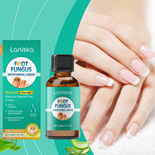 Laniska ָ�׻�������Һ �ճ��ǻ���������ָ�׽��ʲ������Һ
