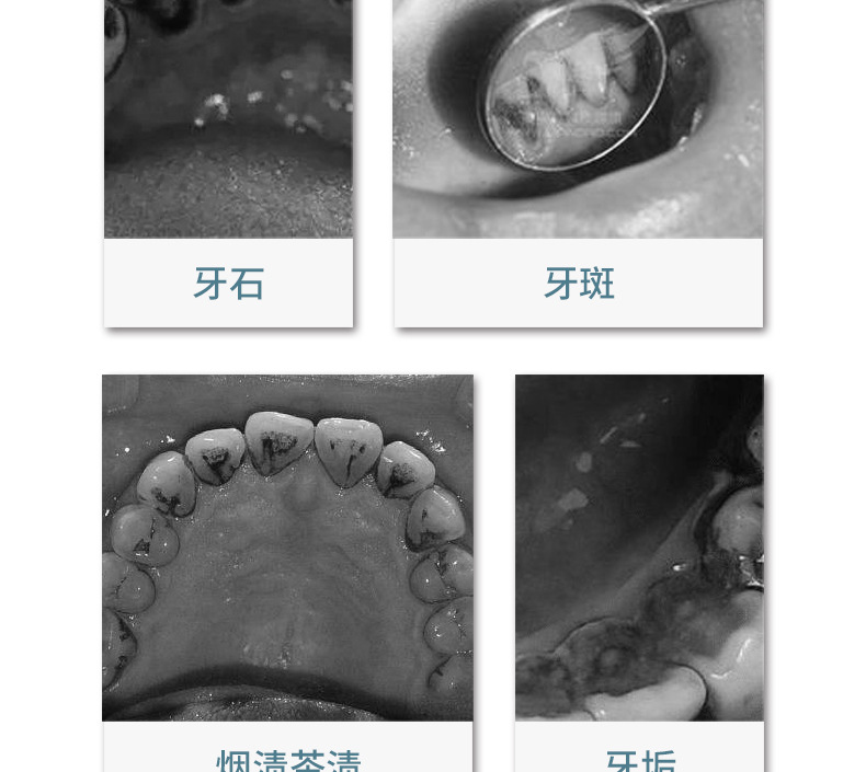 B款超声波牙器产品详情---1_04.jpg