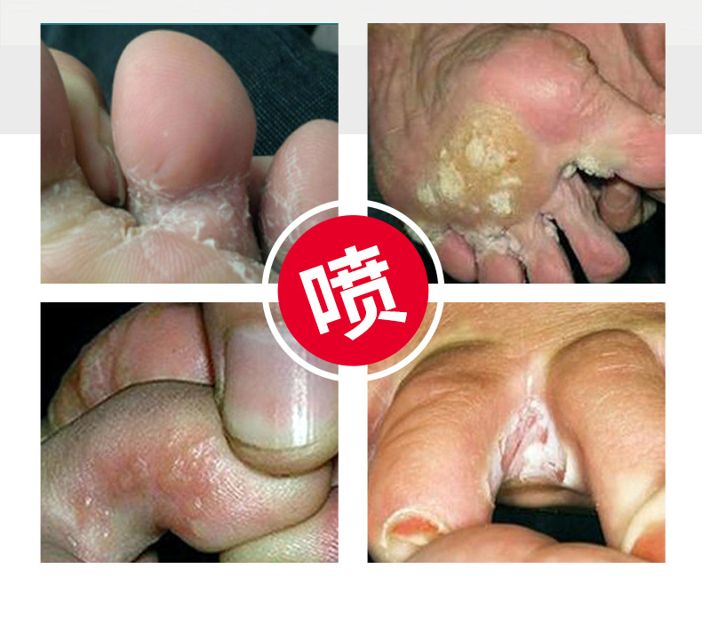 日本東京生物足部抑菌,噴劑腳臭腳汗腳氣足部異味止癢抑菌液 日本東京生物足部抑菌