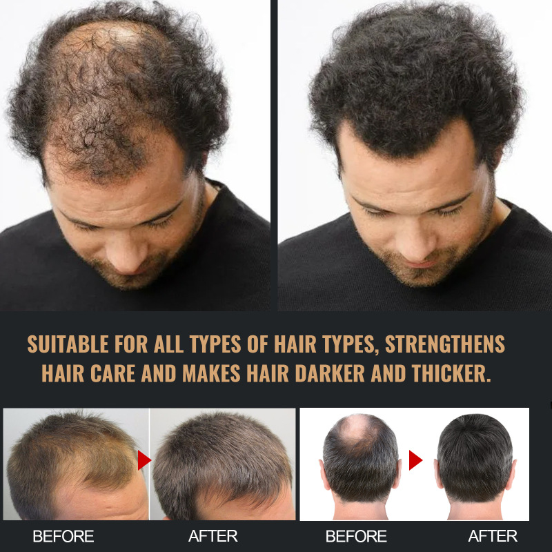 EELHOE シャンプー ジェントル クレンジング ヘア ナチュラル ふわふわ ヘア スムース ケア ヘアケア シャンプー|undefined