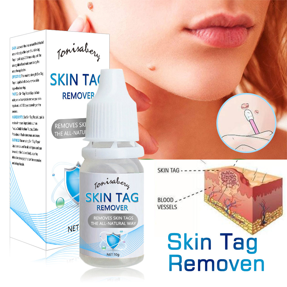 Skin Tag-Reinigungsflüssigkeit zur Wachstumskontrolle, Hühneraugenklappe und Entfernung von Dornwarzen_voghion.com