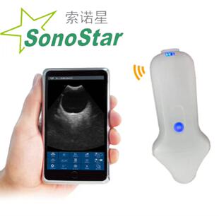 Sonostar���Z�� �S��ֱ�N �y�����F���o������B��̽�^ ԃ�Ά��r