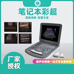 笔记本式彩超  医用彩超机 基层 便携式彩超  便携式b超机