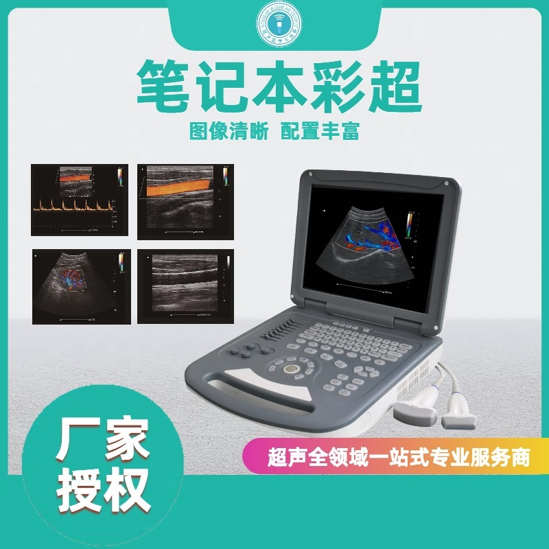 笔记本式彩超  医用彩超机 基层 便携式彩超  便携式b超机|undefined