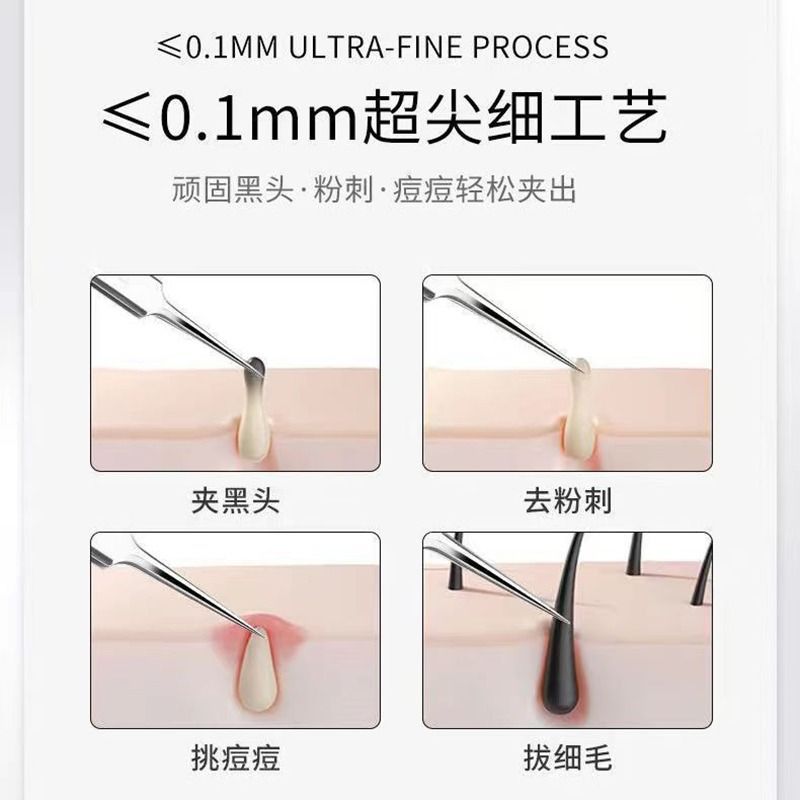 家用去黑头细胞夹子镊子粉刺针全套 美容专业不锈钢粉刺针4件套装|undefined